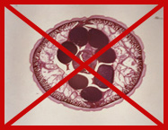 parasite